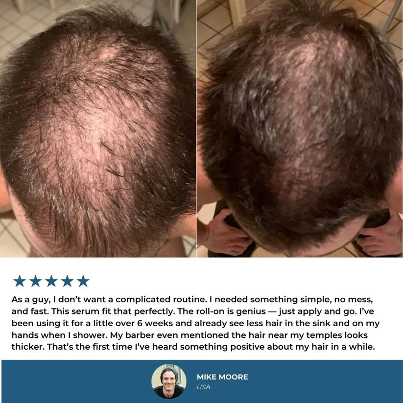 Hair Growth Roll-On