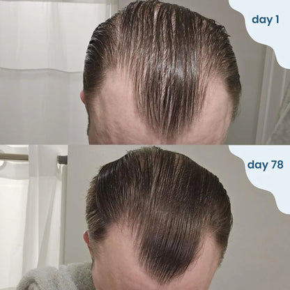 Hair Growth Roll-On