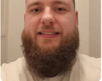 Suffered seb derm in face/beard for over 3 years